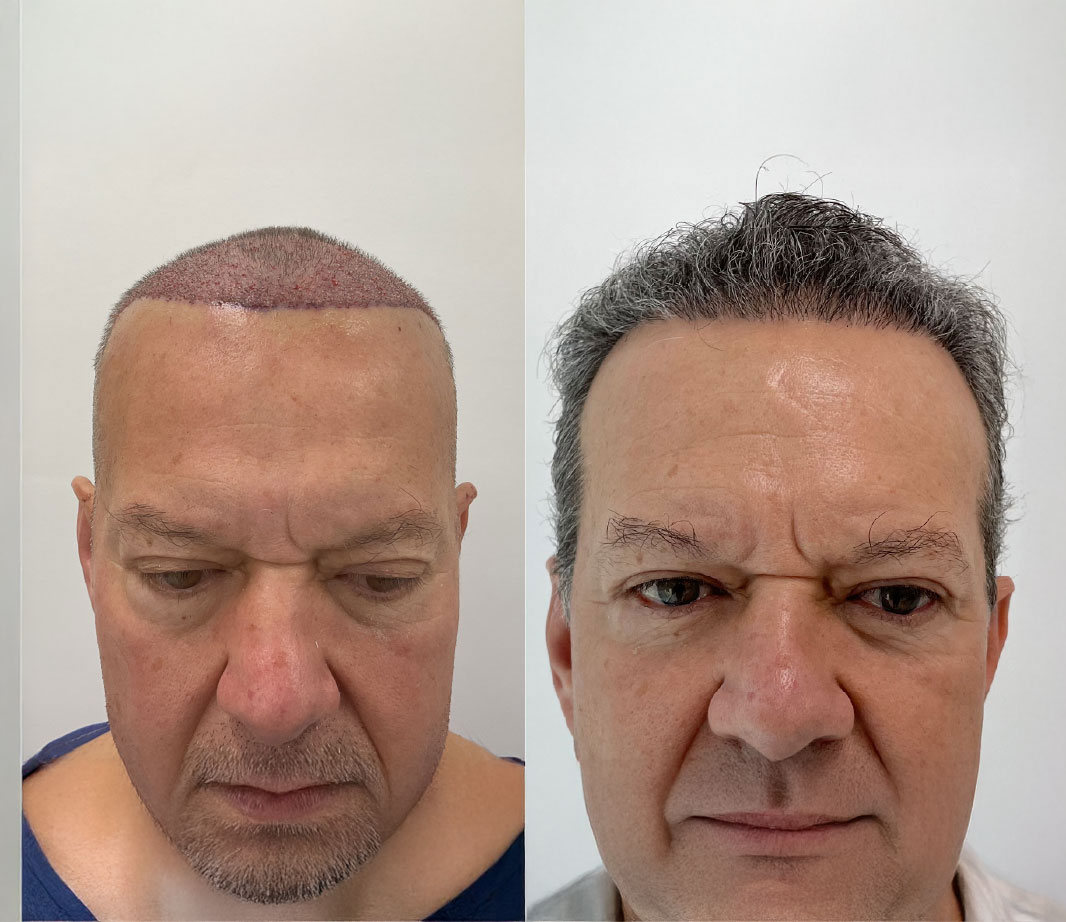 testimonial image